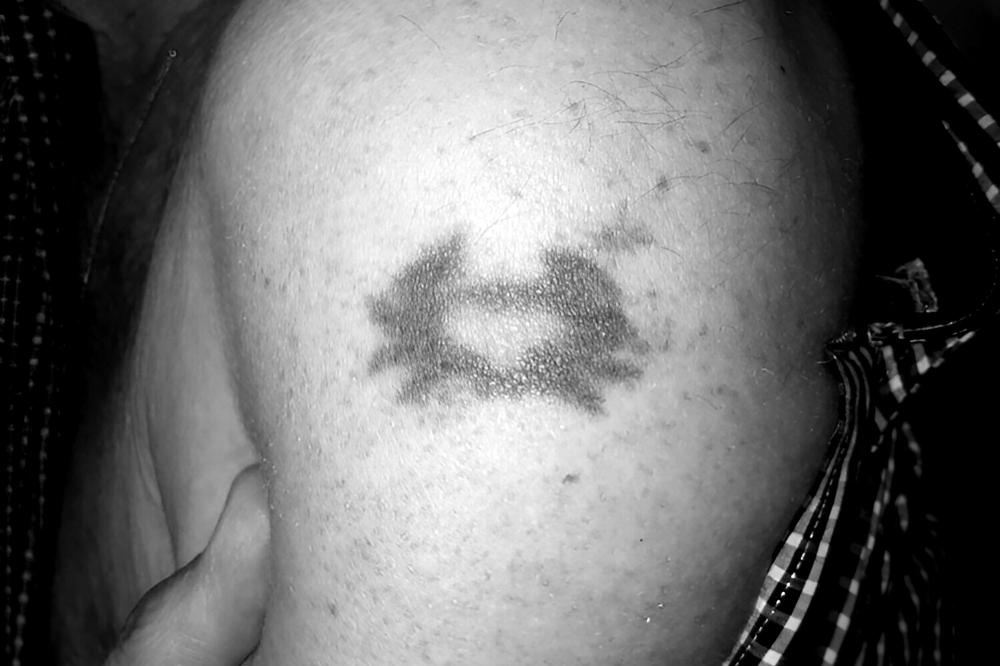 tatouages raté
