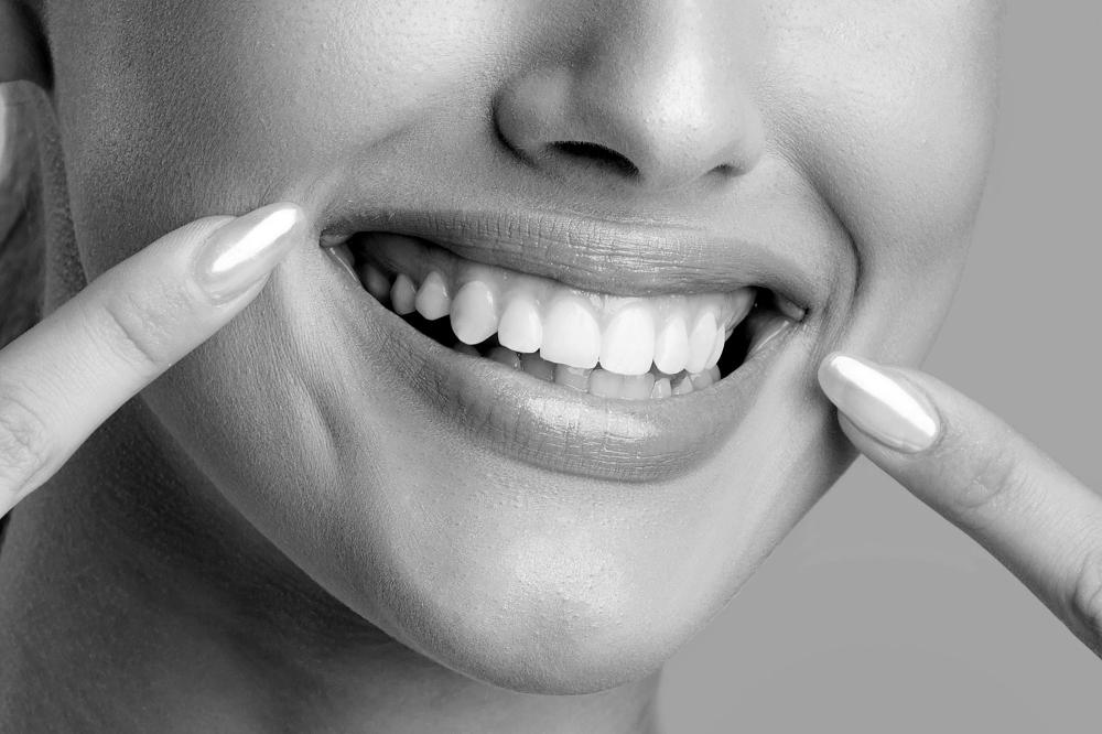 dents blanches